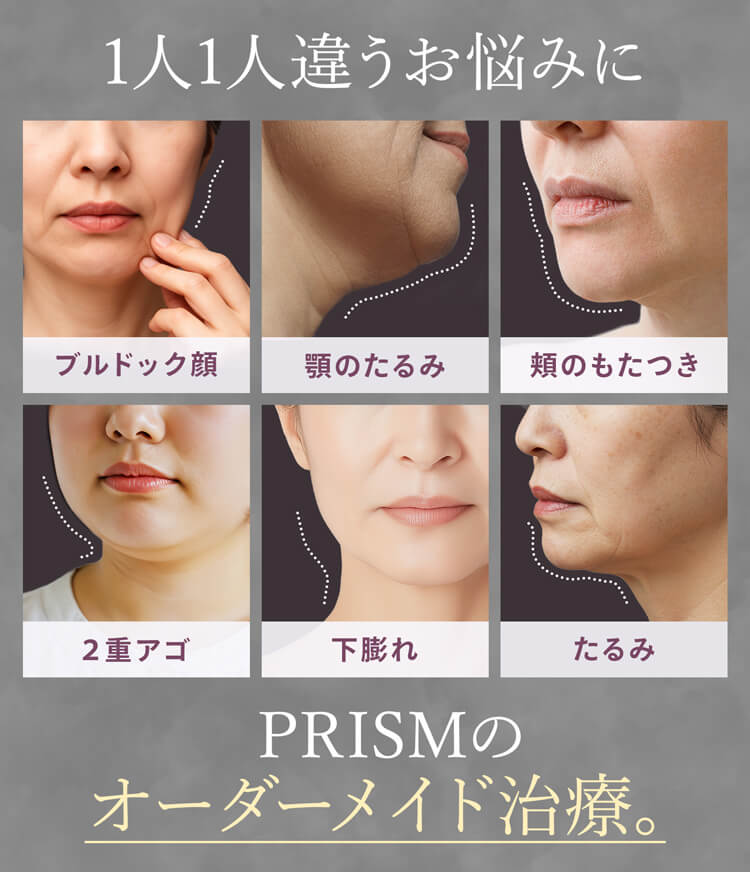 あらゆるお顔の悩みPRISMで理想の小顔に。