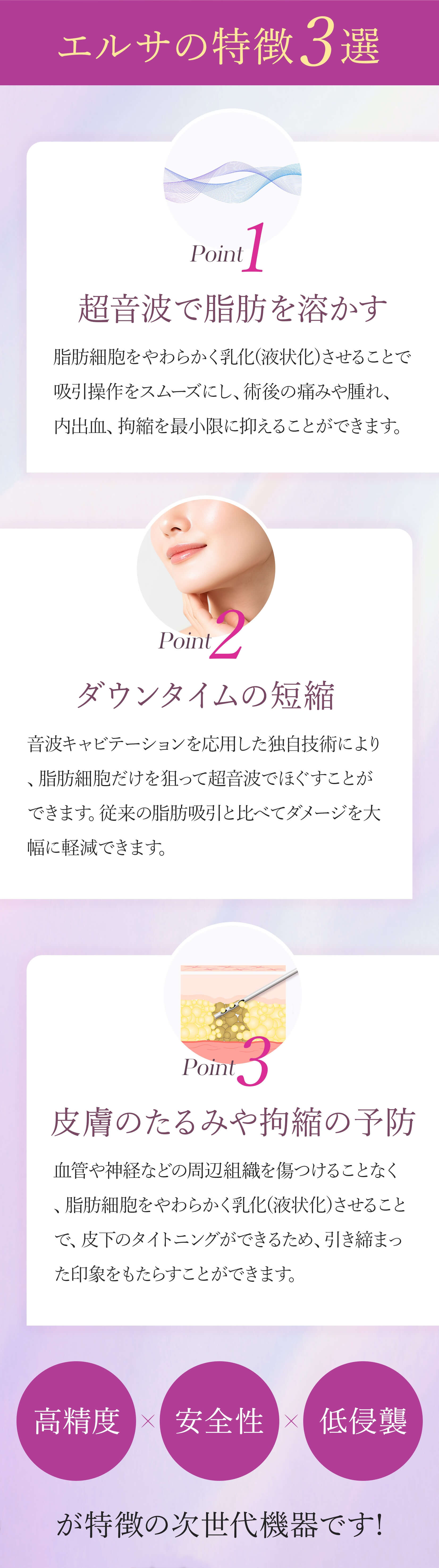 エルサの特徴3選